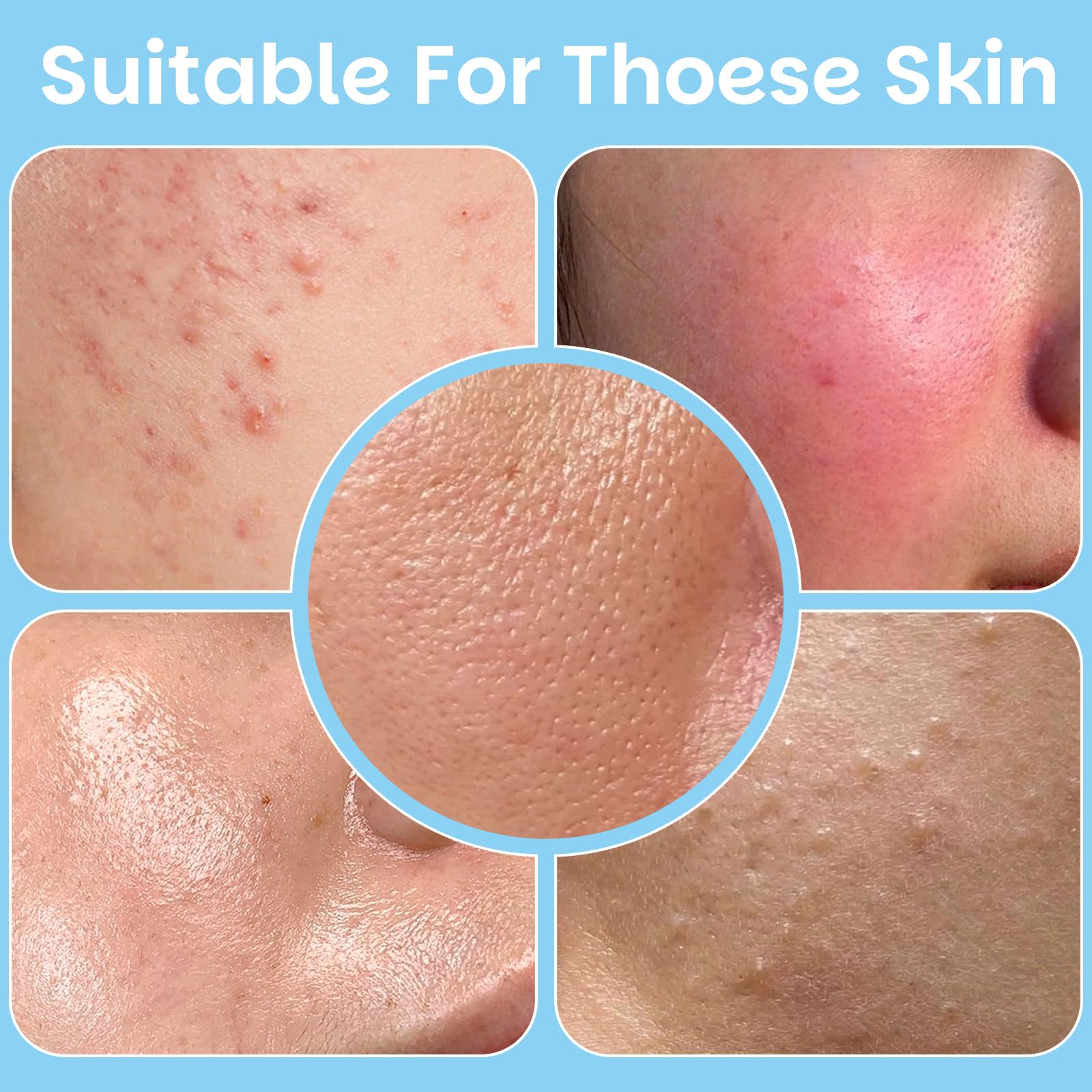 Kestper salicylic pad oil-control action on skin surface