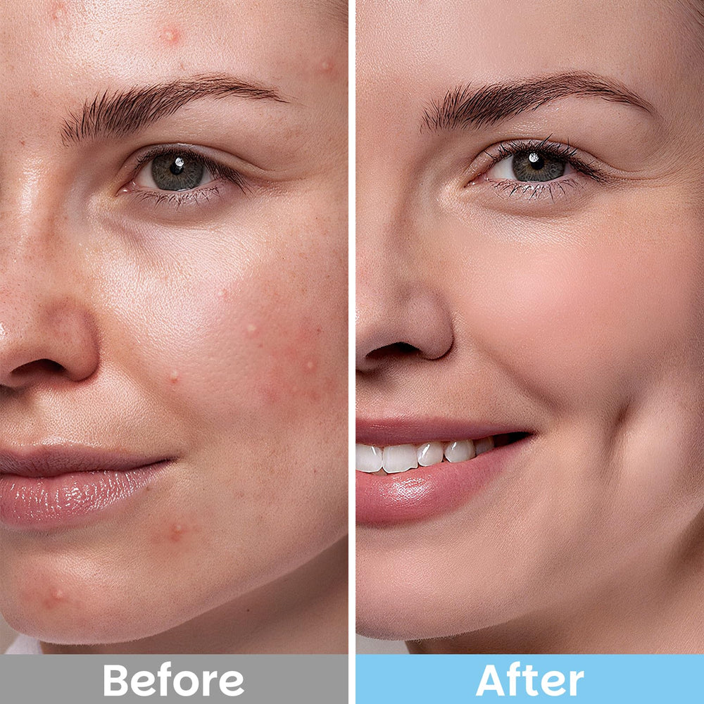 Kestper salicylic pad texture detail shows dual-textured exfoliation