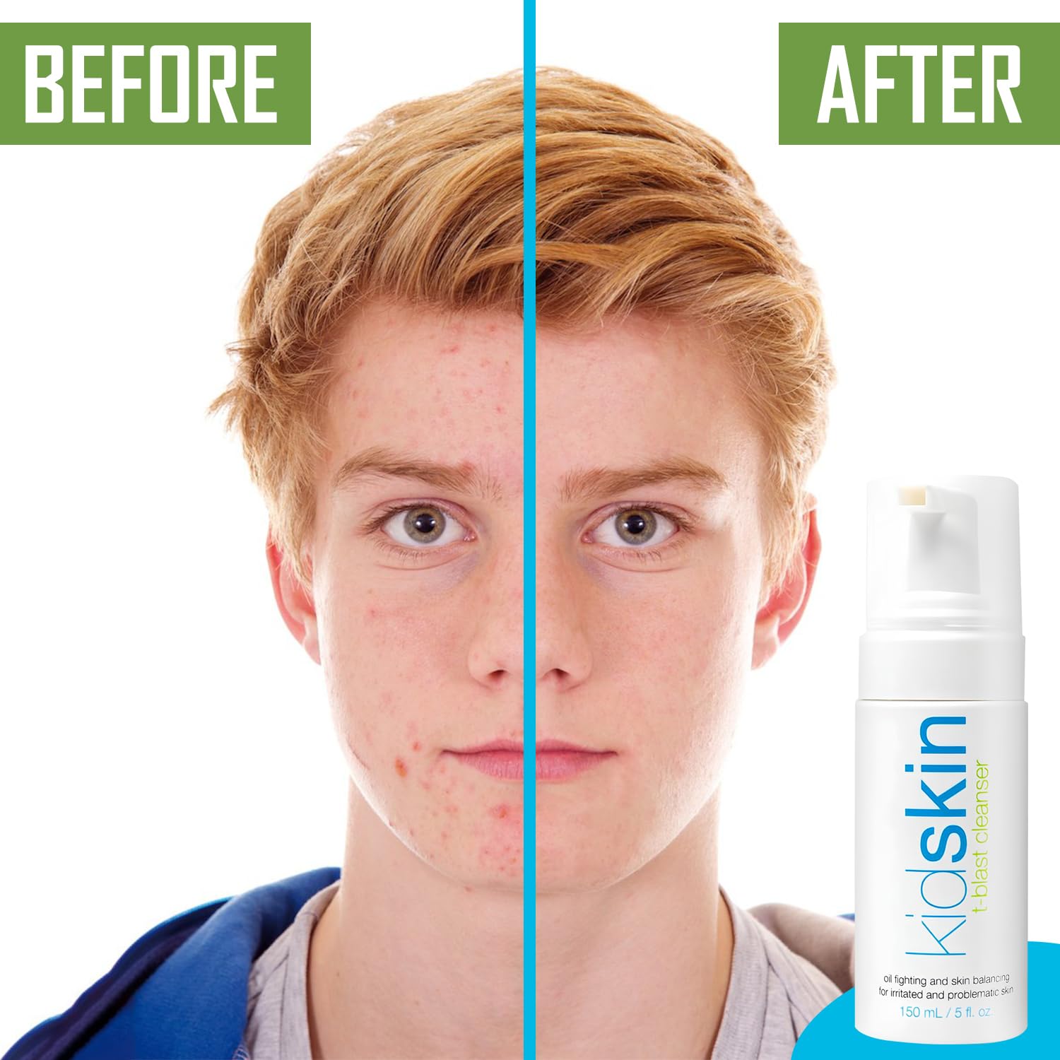 Kidskin dermatologist-approved label signals trusted teen skincare.