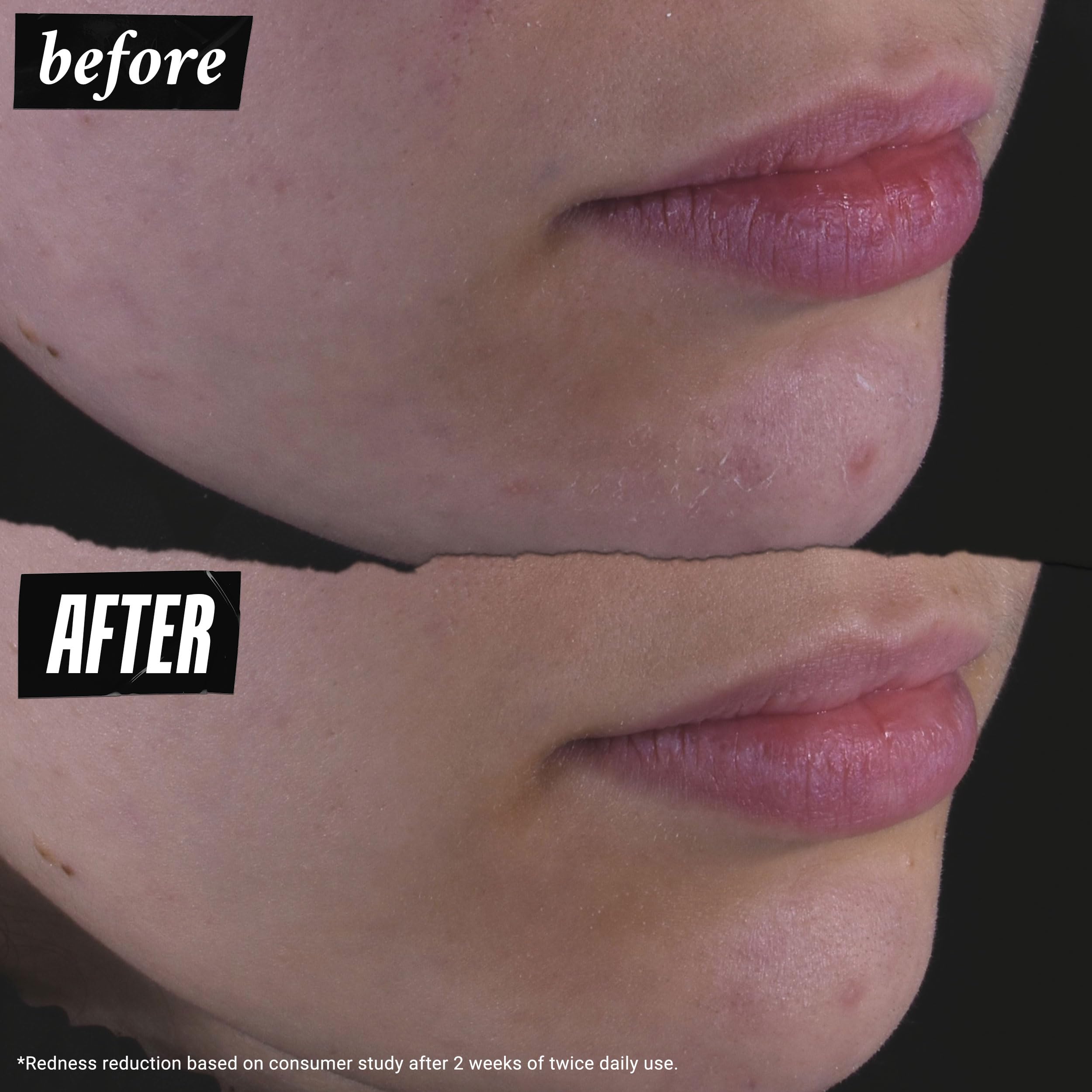 Kiehl's Calendula Toner after cleansing use on clean skin