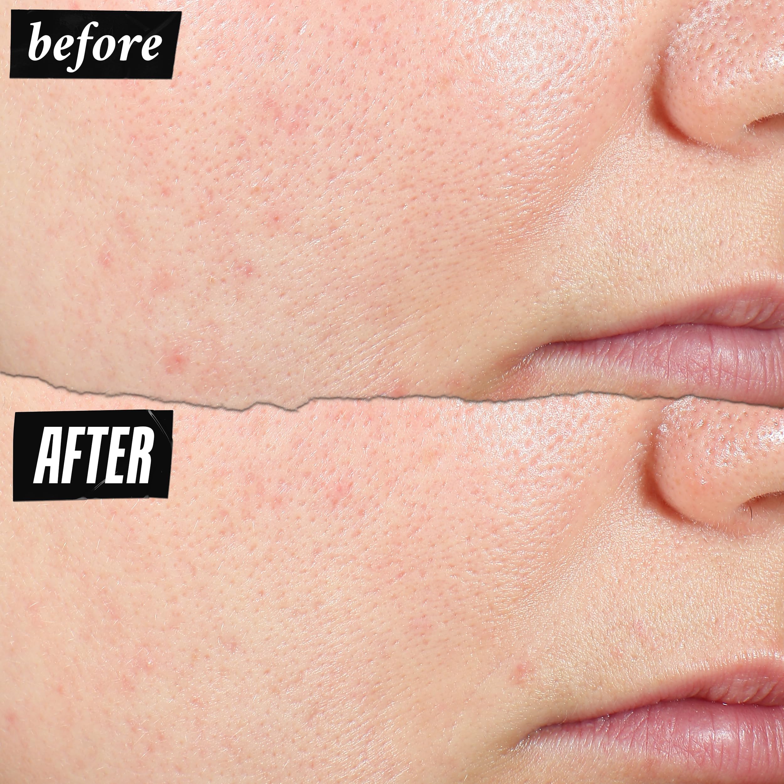 Kiehl's Expertly Clear close look at Salicylic Acid 1.2% for pore-clearing action.