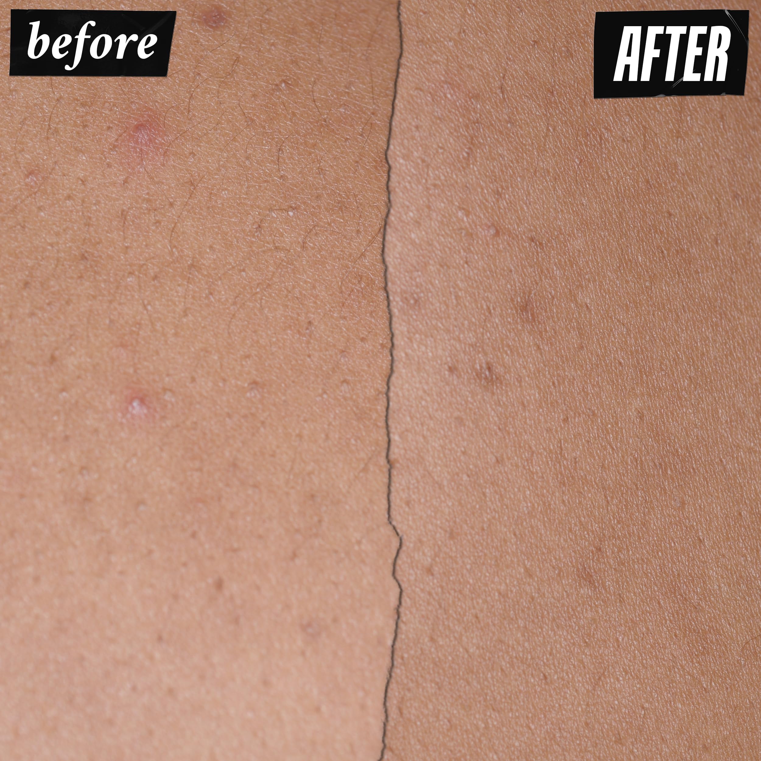 Kiehl's Expertly Clear texture image suggests a hydrating, non-drying feel during application.