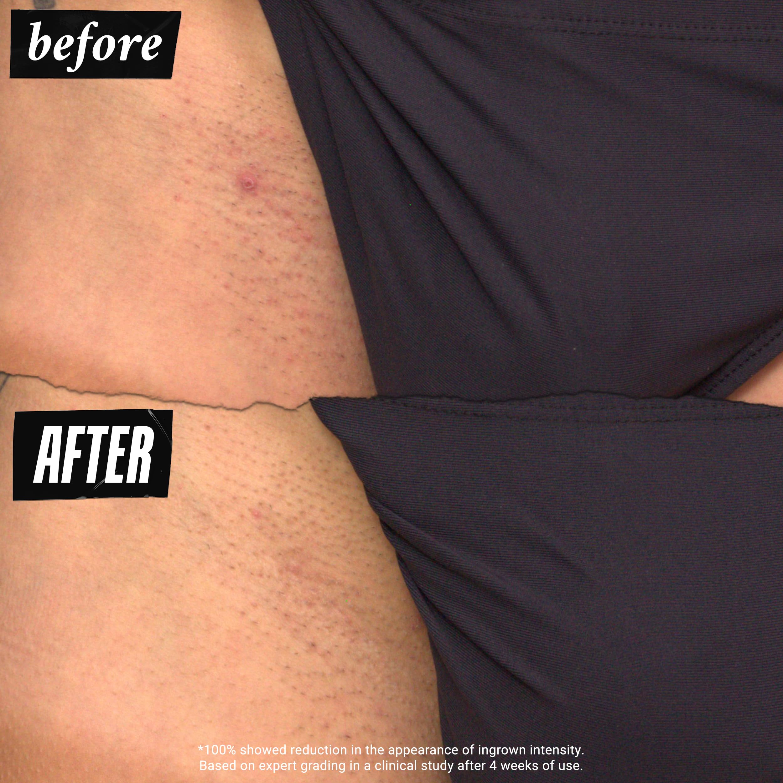 Kiehl's Ingrown Hair Drops fast-drying formula shown on fabric without staining