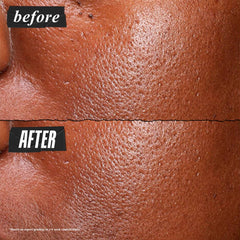 Kiehl's Niacinamide Serum texture close-up shows lightweight, fast absorption.