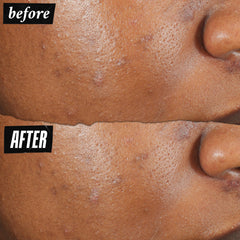 Kiehl's patch-dry-down visual demonstrates quick-drying, breathable coverage.