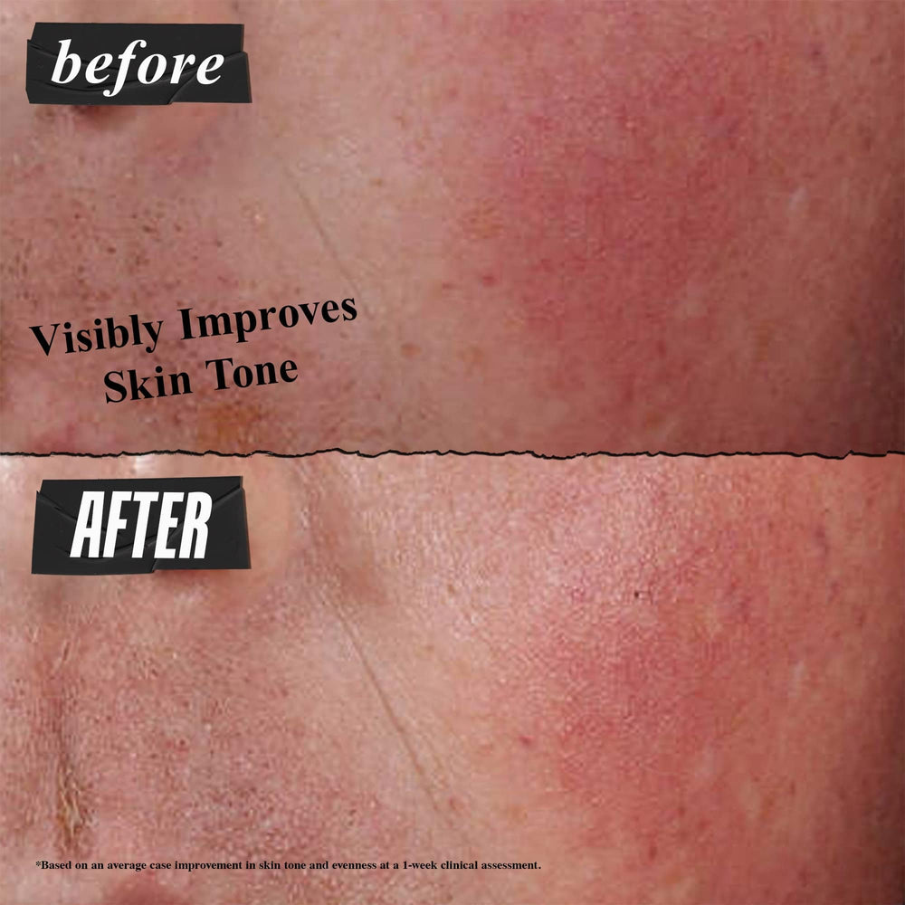 Kiehl's Ultra Facial Advanced Repair Barrier Cream application shows massage into cleansed skin.
