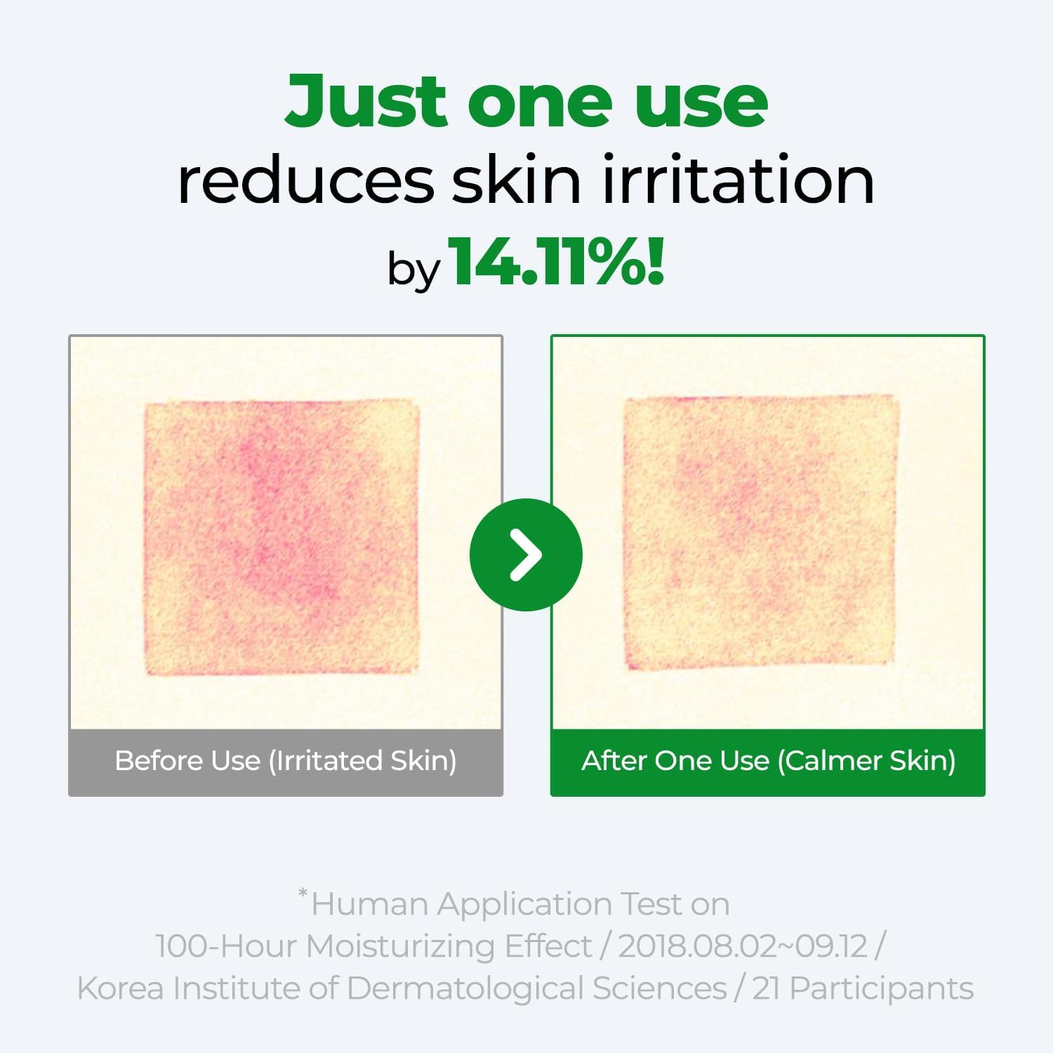 Kim Jeong Moon Aloe Cure Intensive used on elbows and heels for supple skin.