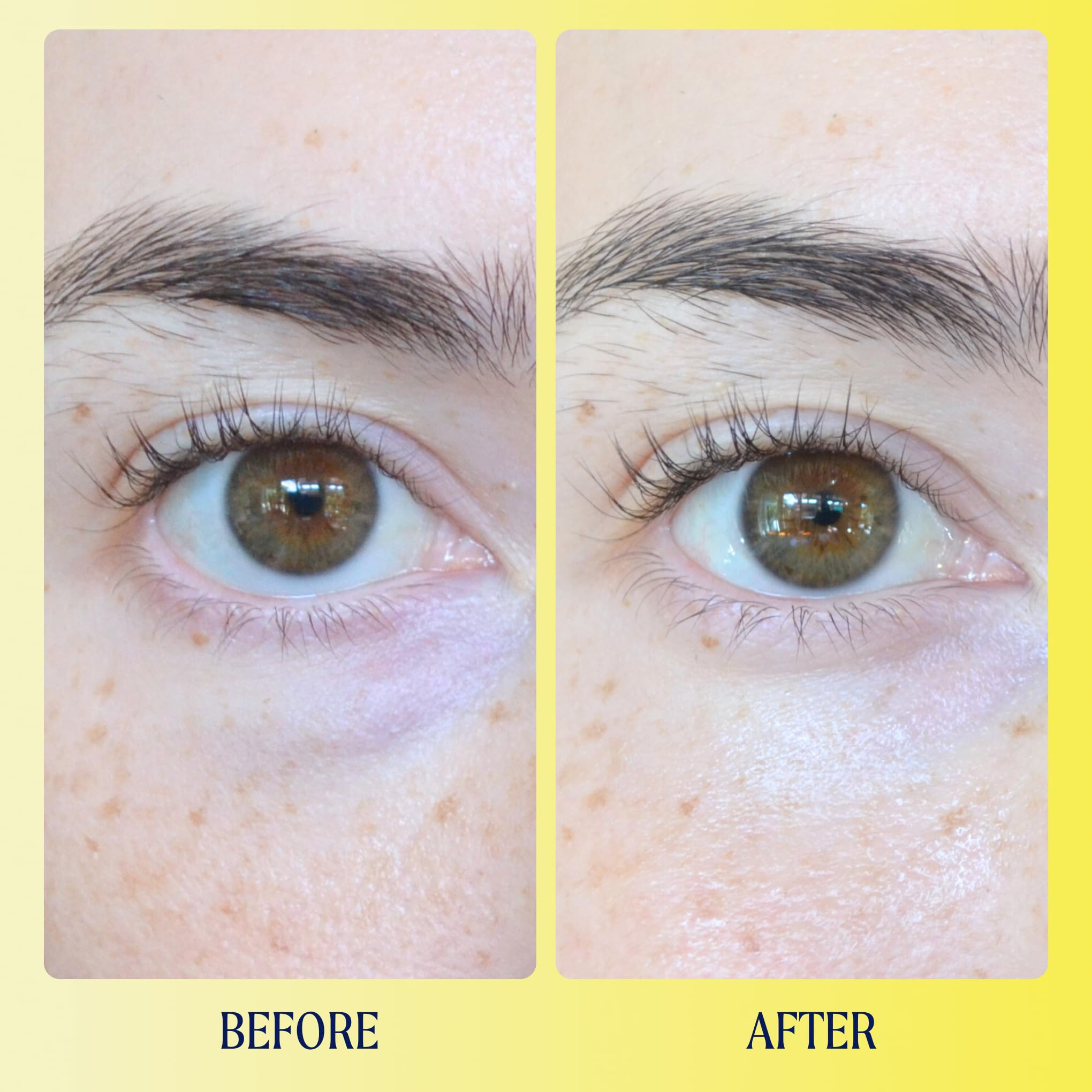 Kinship Brightwave glow under-eye hints at hydrating, even-toned appearance