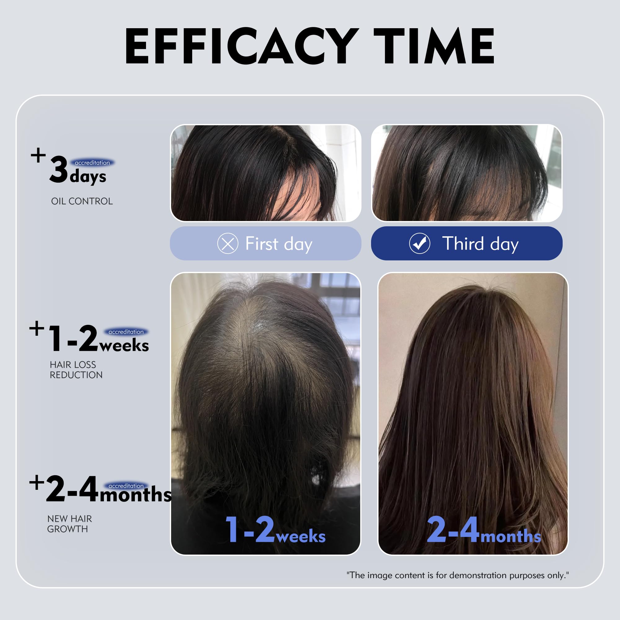 KINTOR KX-826 scalp massage post-spray, promotes absorption and follicle support