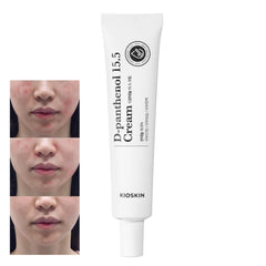 KIOSKIN skin 8-types hyaluronic acid close-up demonstrates multi-depth hydration.