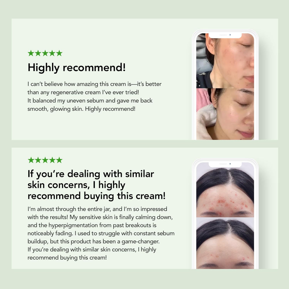 KIOSKIN skin barrier-repair-hydration-cream-cap shows smooth-application.