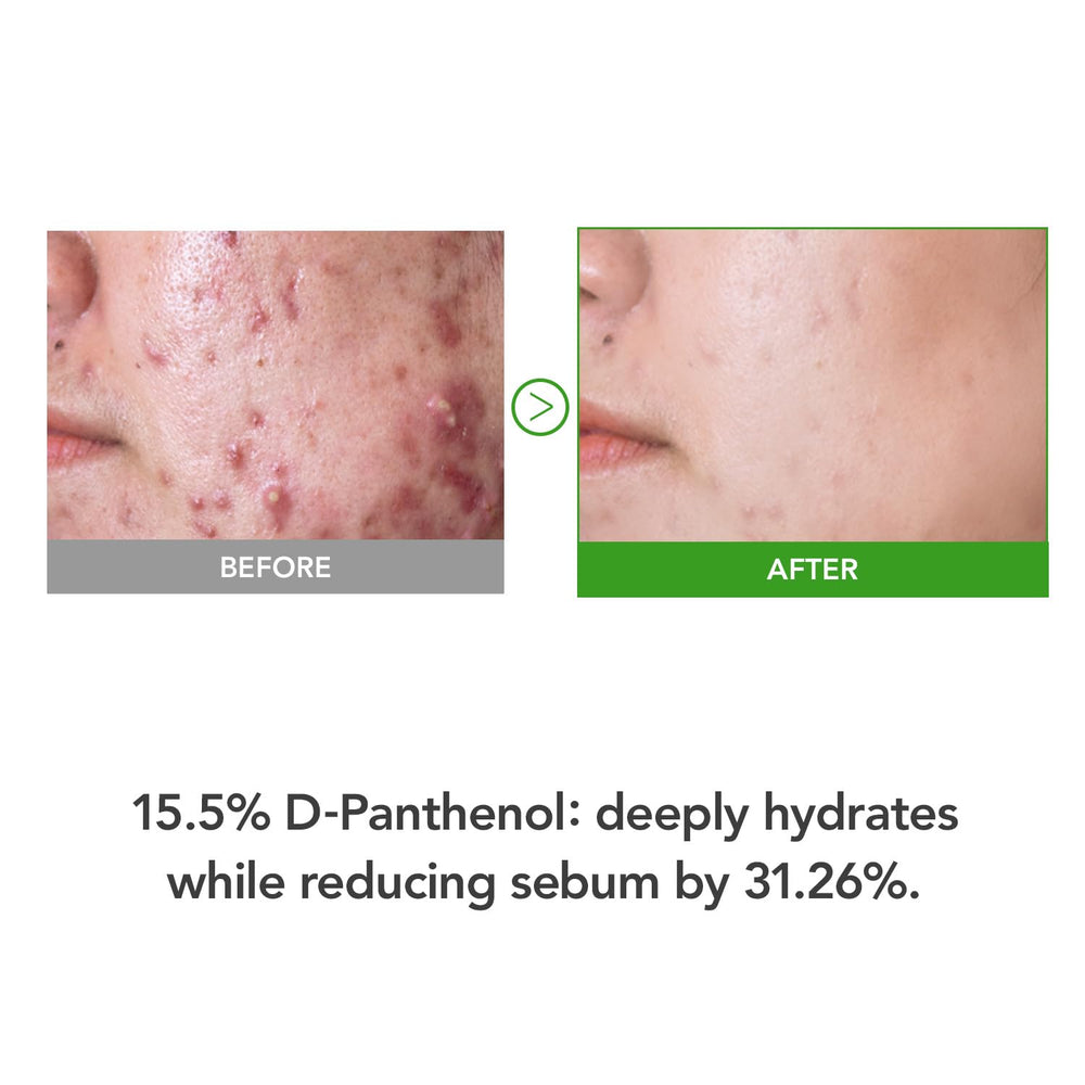 KIOSKIN skin d panthenol 15-5-percent face cream highlights barrier support.