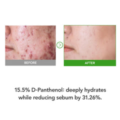 KIOSKIN skin d panthenol 15-5-percent face cream highlights barrier support.
