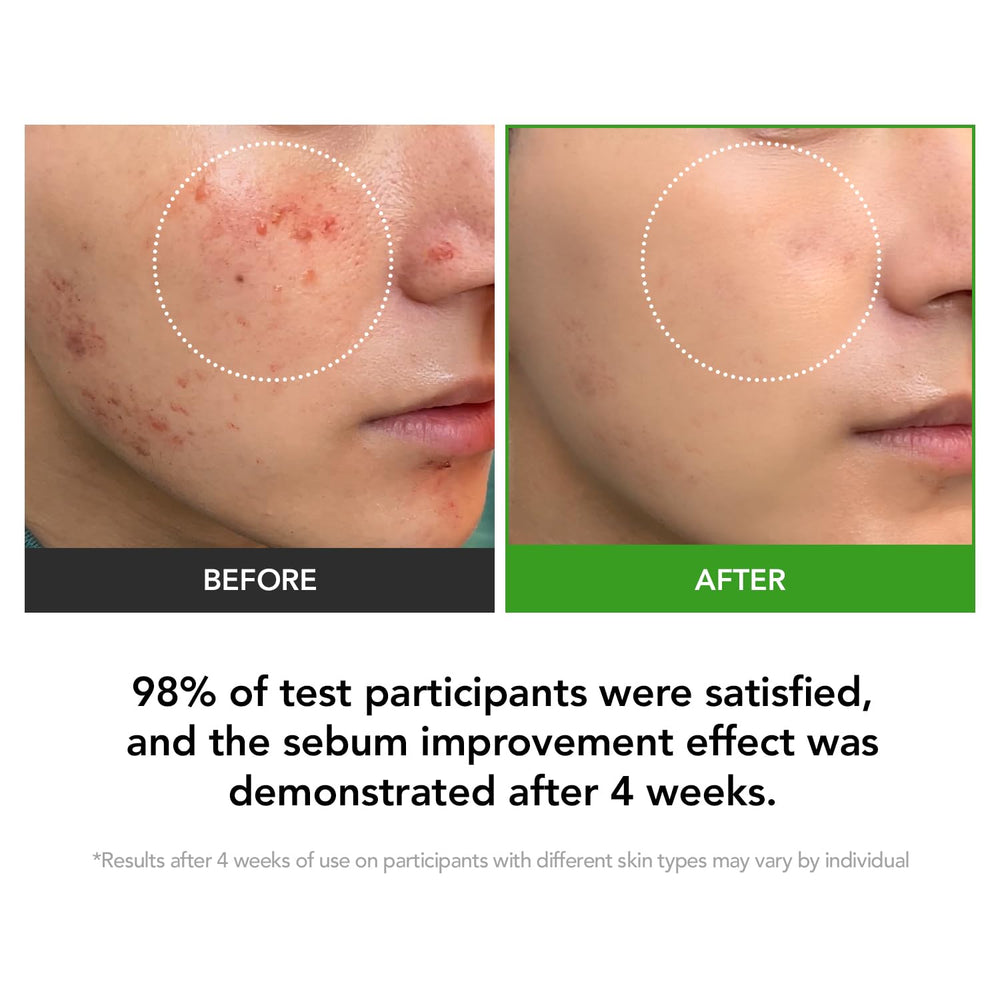 KIOSKIN skin heartleaf extract anti-redness serum showcases calming redness relief use.