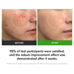 KIOSKIN skin heartleaf extract anti-redness serum showcases calming redness relief use.