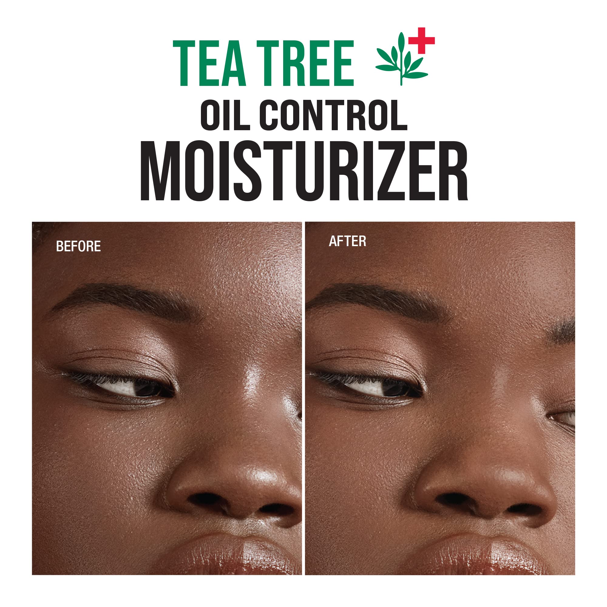 Kiss New York Tea Tree Face Moisturizer cica extract highlights barrier support for sensitive skin