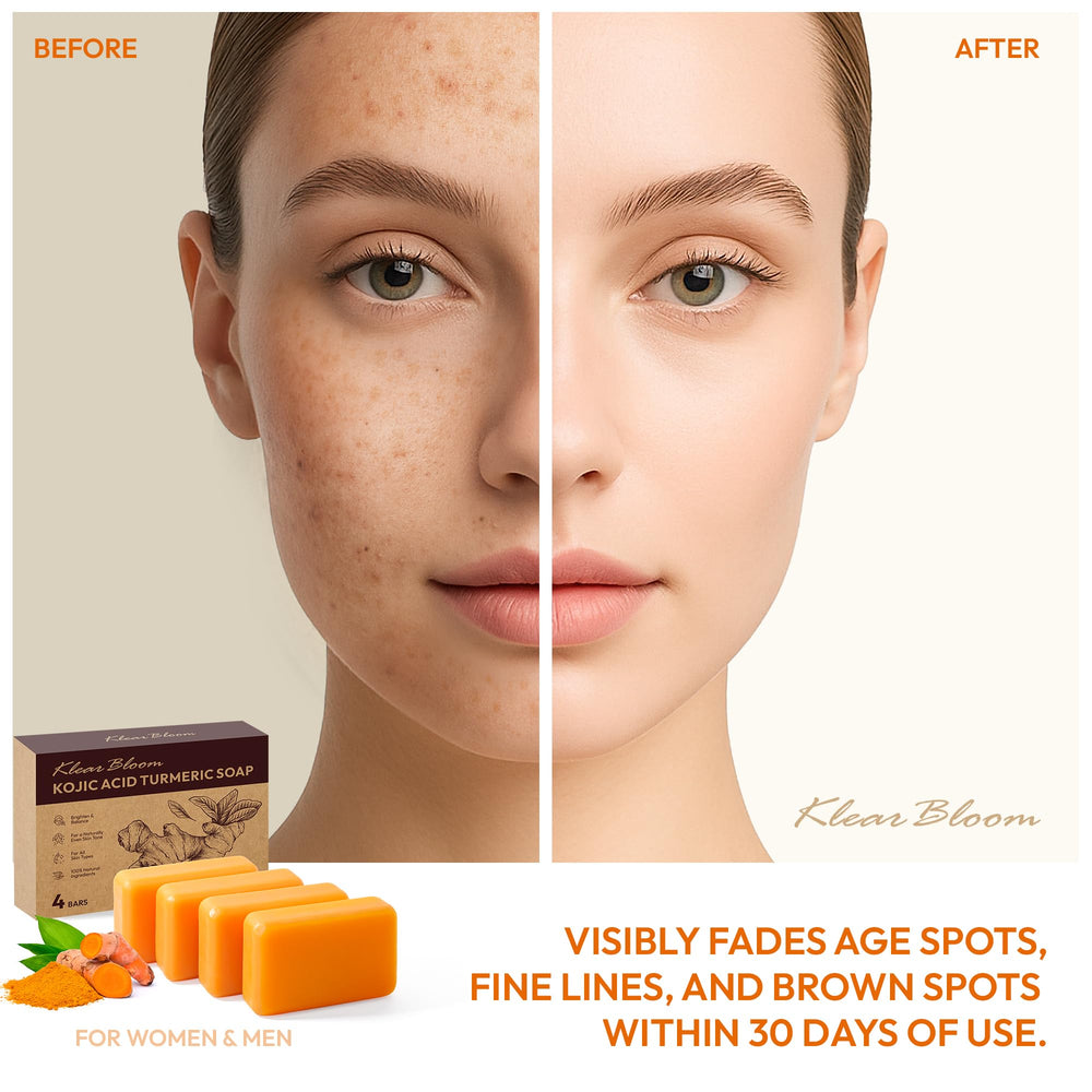 KlearBloom Kojic Acid Turmeric Soap Bar lathering action for radiant skin.
