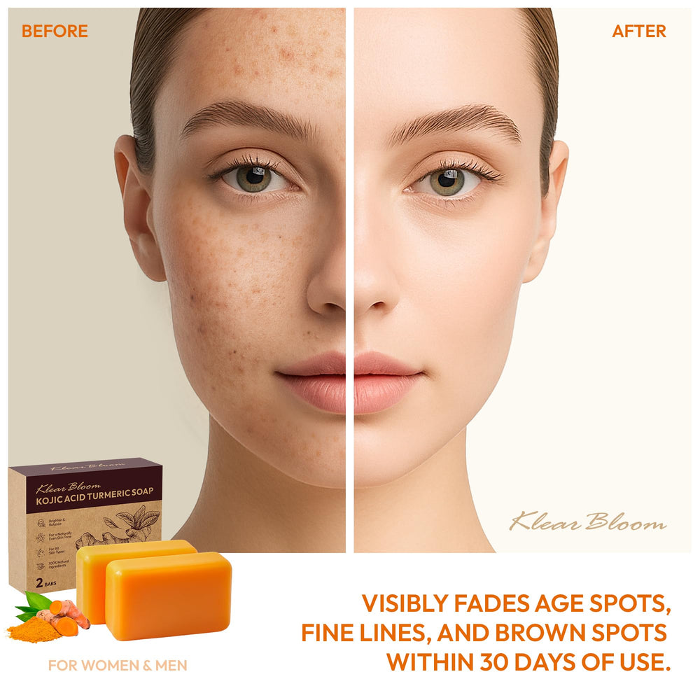 KlearBloom Kojic Turmeric Soap bar closeup highlighting brightening formula.