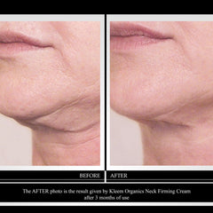 Kleem Organics retinol cream texture closeup suggests smooth, youthful-looking skin and wrinkle reduction potential