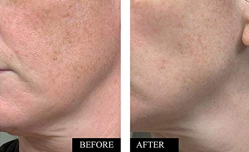 Kleem Organics Vitamin C Serum being applied in a morning skincare routine