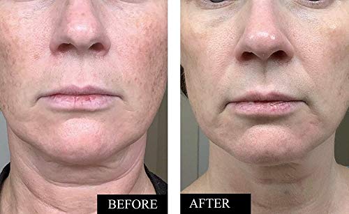Kleem Organics Serum texture swatch displaying lightweight non-greasy hydration