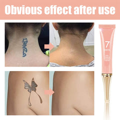 KlsyChry tattoo removal cream massage demonstrating skin-friendly coverage and quick absorption.