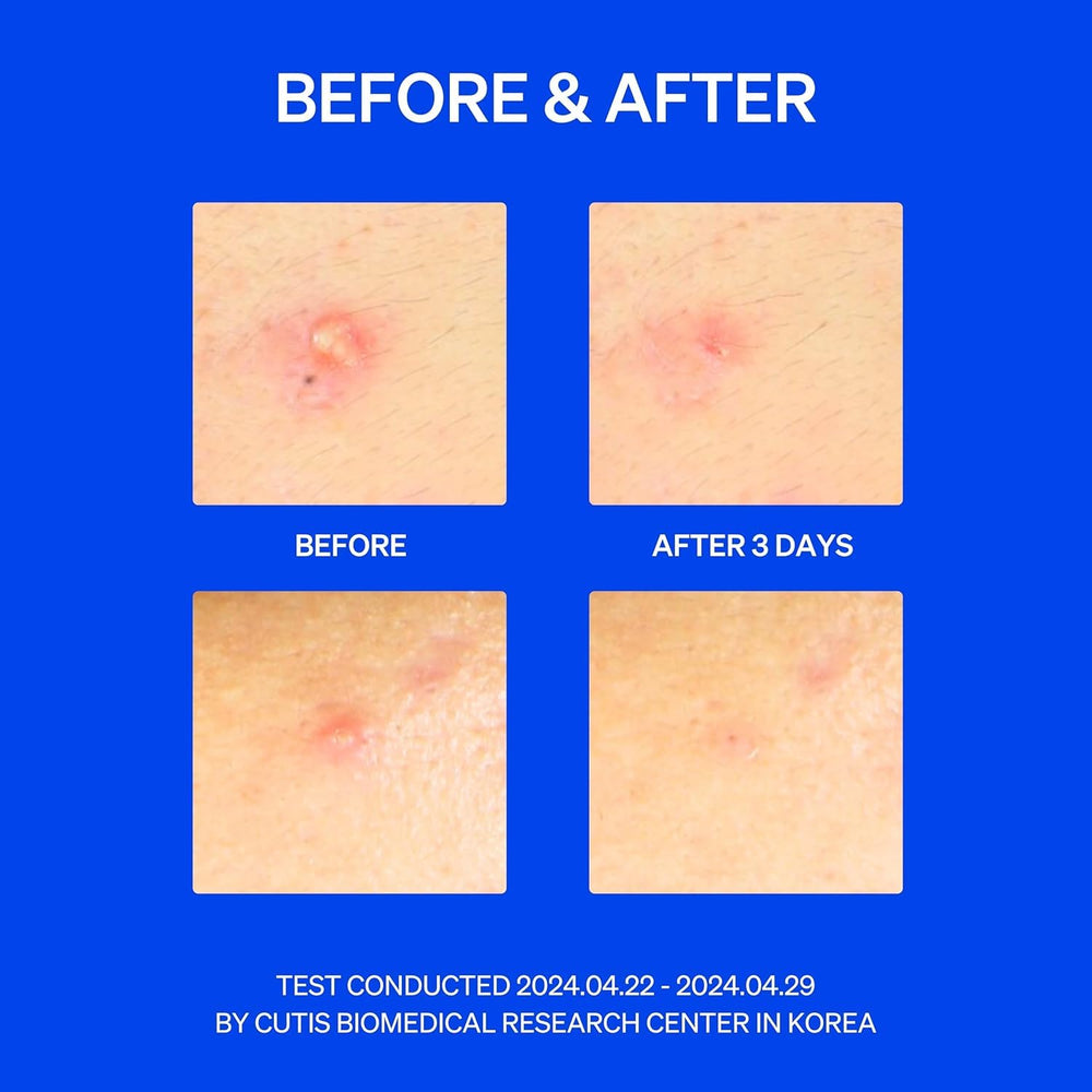 KNEMO patch center-thick absorbent core captures whitehead gunk effectively