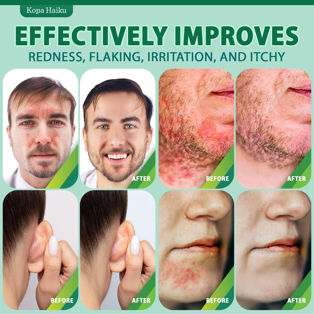 KOPA HAIKU scalp and chest use shows versatile application.