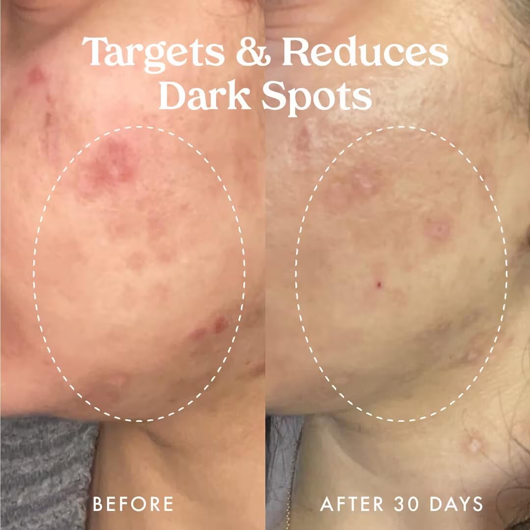 Kopari Star Bright bottle on morning routine setup suggests radiant, healthy-looking skin.