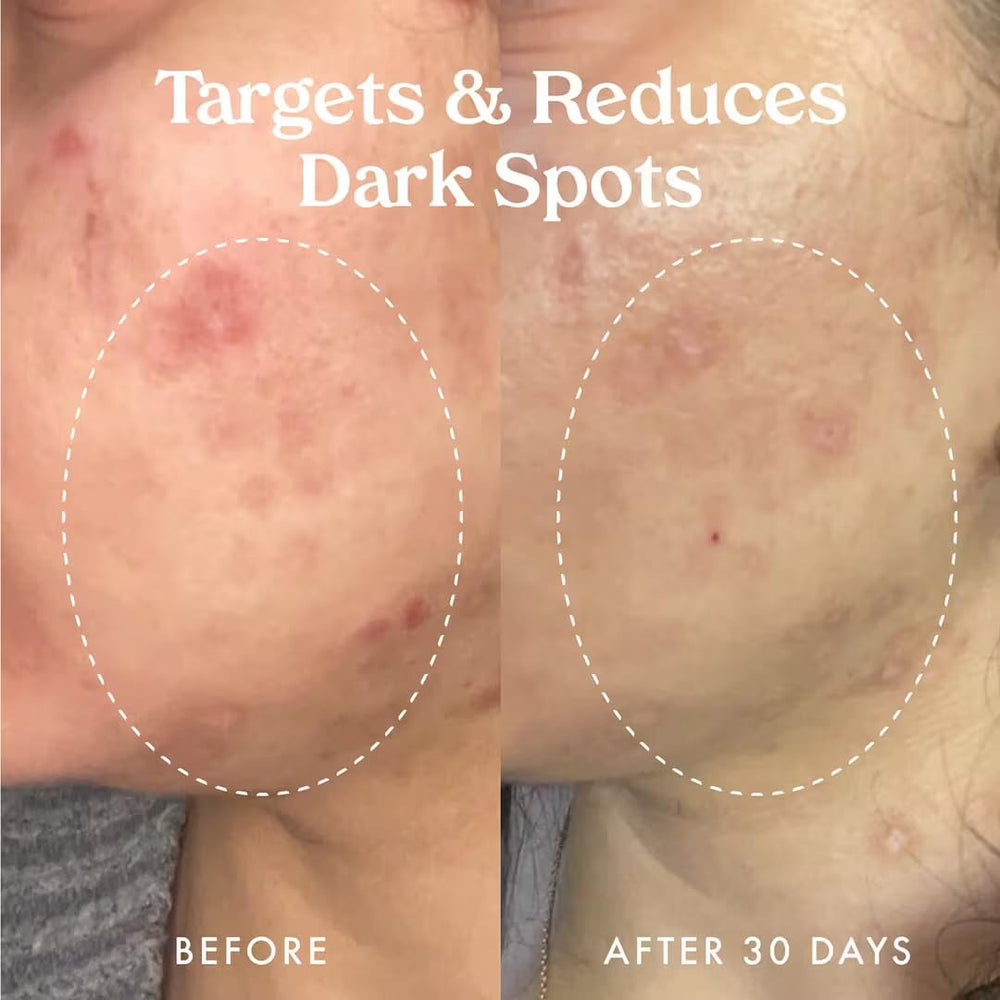 Kopari Star Bright bottle on morning routine setup suggests radiant, healthy-looking skin.