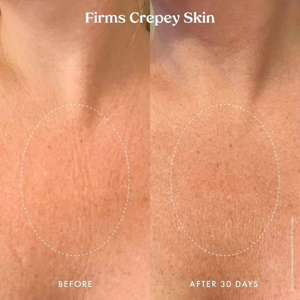 Applying Kopari Ultra Renewal Retinol Body Cream for a smooth, hydrated skin feel during routine.
