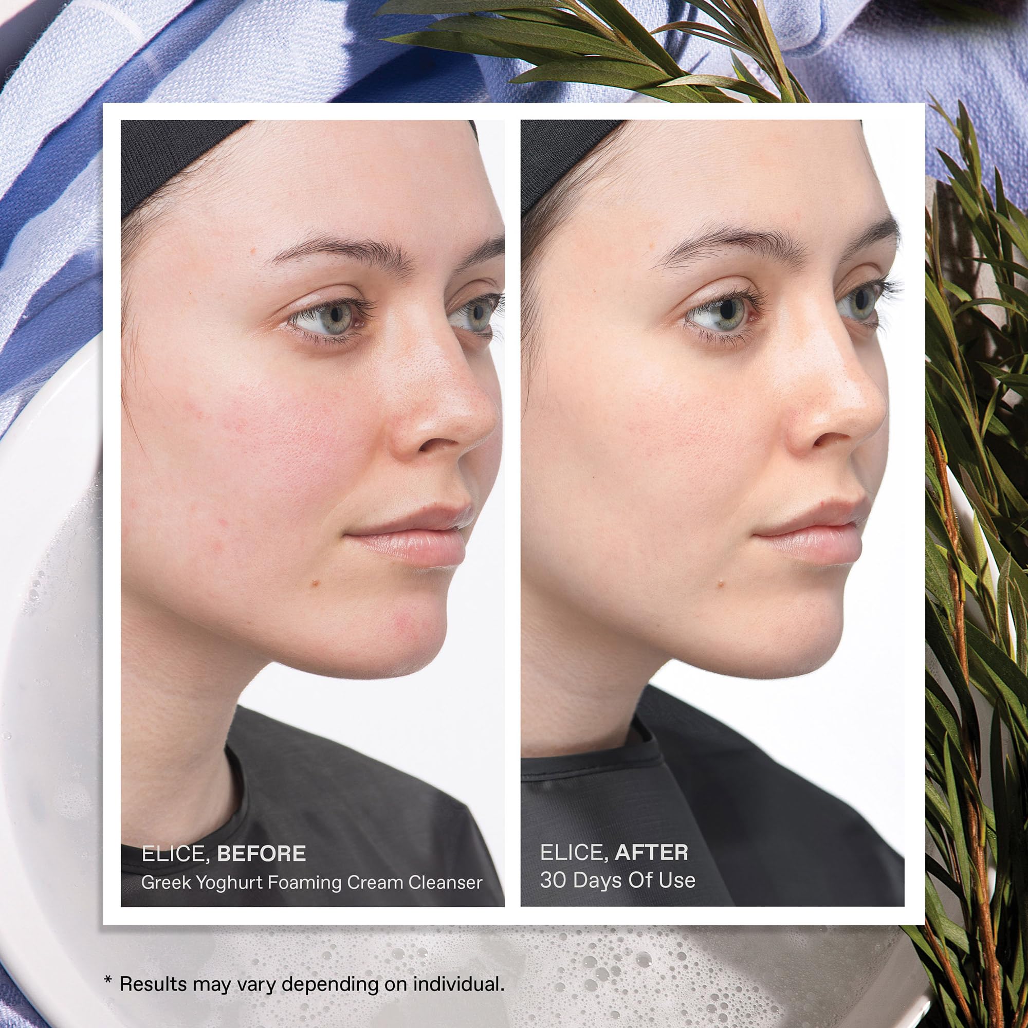 KORRES Greek Yoghurt Foaming Cream Cleanser dermatologically tested packaging signals reliability.