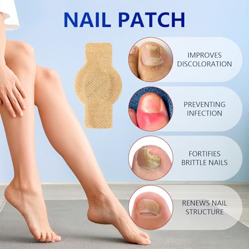 Kosimi Nail Patches damaged-nail-after closeup after use.