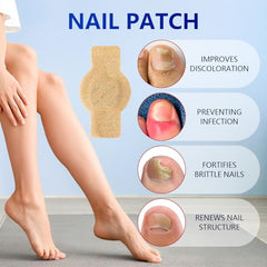 Kosimi Nail Patches damaged-nail-after closeup after use.