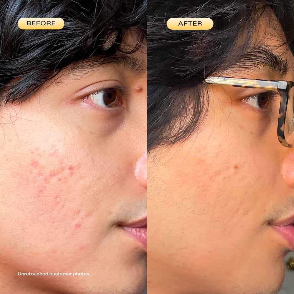 KraveBeauty 24 Carrot Retinal dropper highlights precise nightly application for consistency.