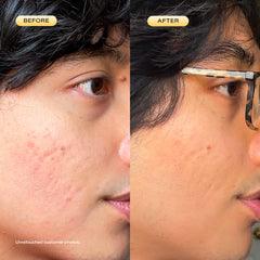 KraveBeauty 24 Carrot Retinal dropper highlights precise nightly application for consistency.