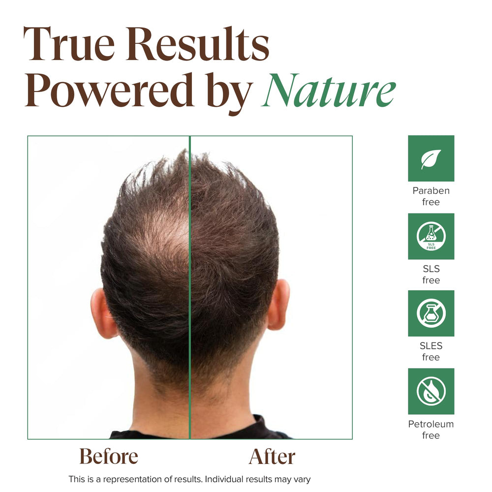 KREYÒL ESSENCE Haitian black castor oil moisturizes hair and skin.