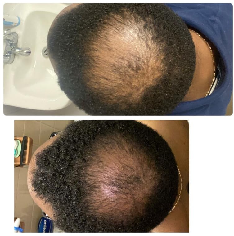 Kreyol Essence application on wet hair shows massage to root for thicker-looking results