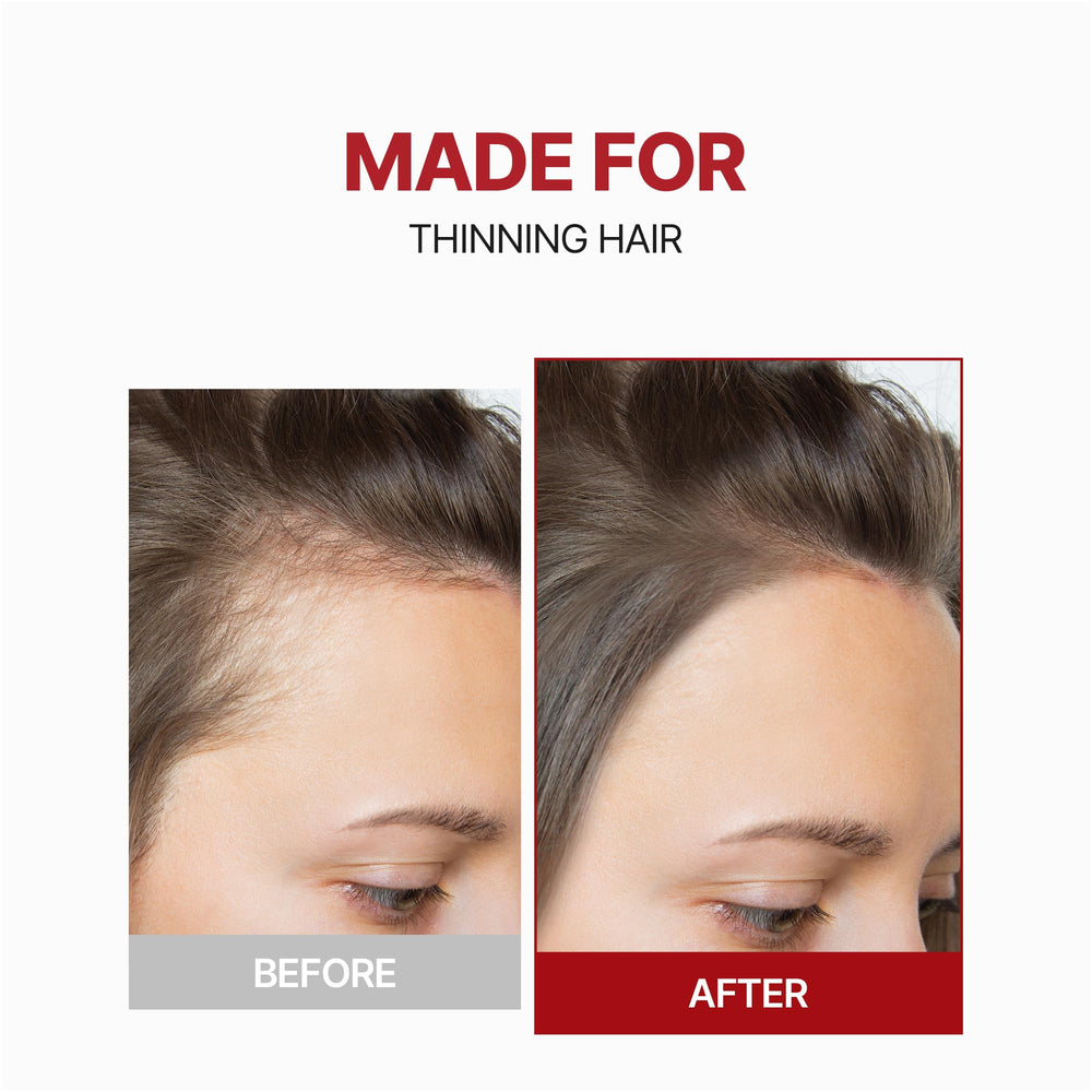 KUNDAL caffeine applicator tip targets scalp precisely during use