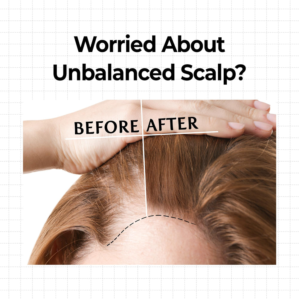 KUNDAL Hair Loss Serum Roll-On 10X caffeine energizes follicles for stronger-looking roots.