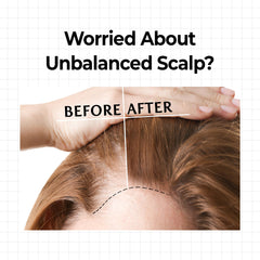 KUNDAL Hair Loss Serum Roll-On 10X caffeine energizes follicles for stronger-looking roots.