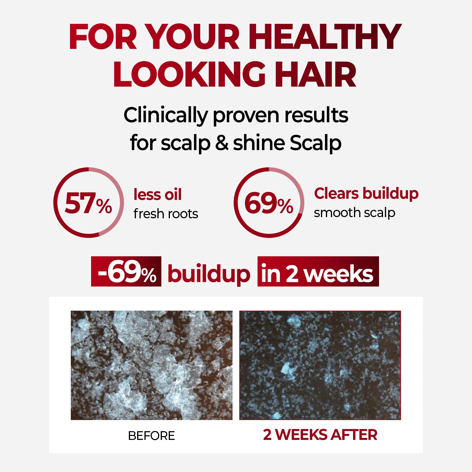 KUNDAL Korean herbal scalp-care bottle highlights nourishing botanical blend