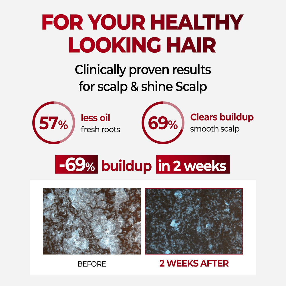 KUNDAL Korean herbal scalp-care bottle highlights nourishing botanical blend