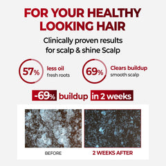 KUNDAL Korean herbal scalp-care bottle highlights nourishing botanical blend