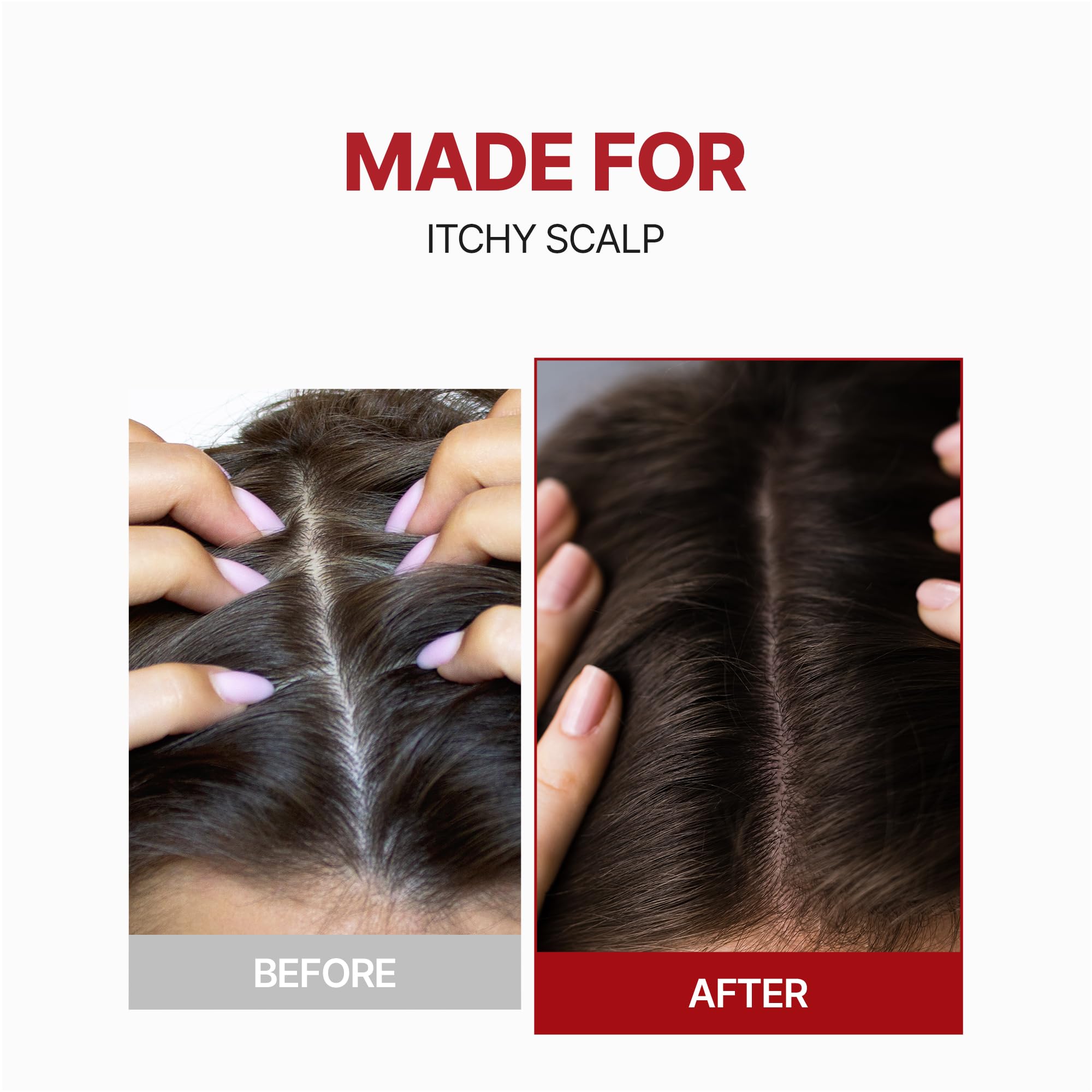 KUNDAL tea tree oil ingredient close-up signals scalp wellness