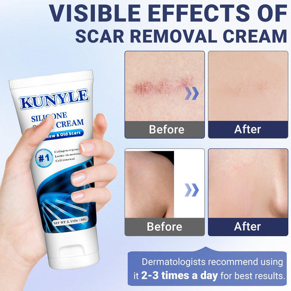 Kunyle Scar Cream jar close-up showing smooth gel texture