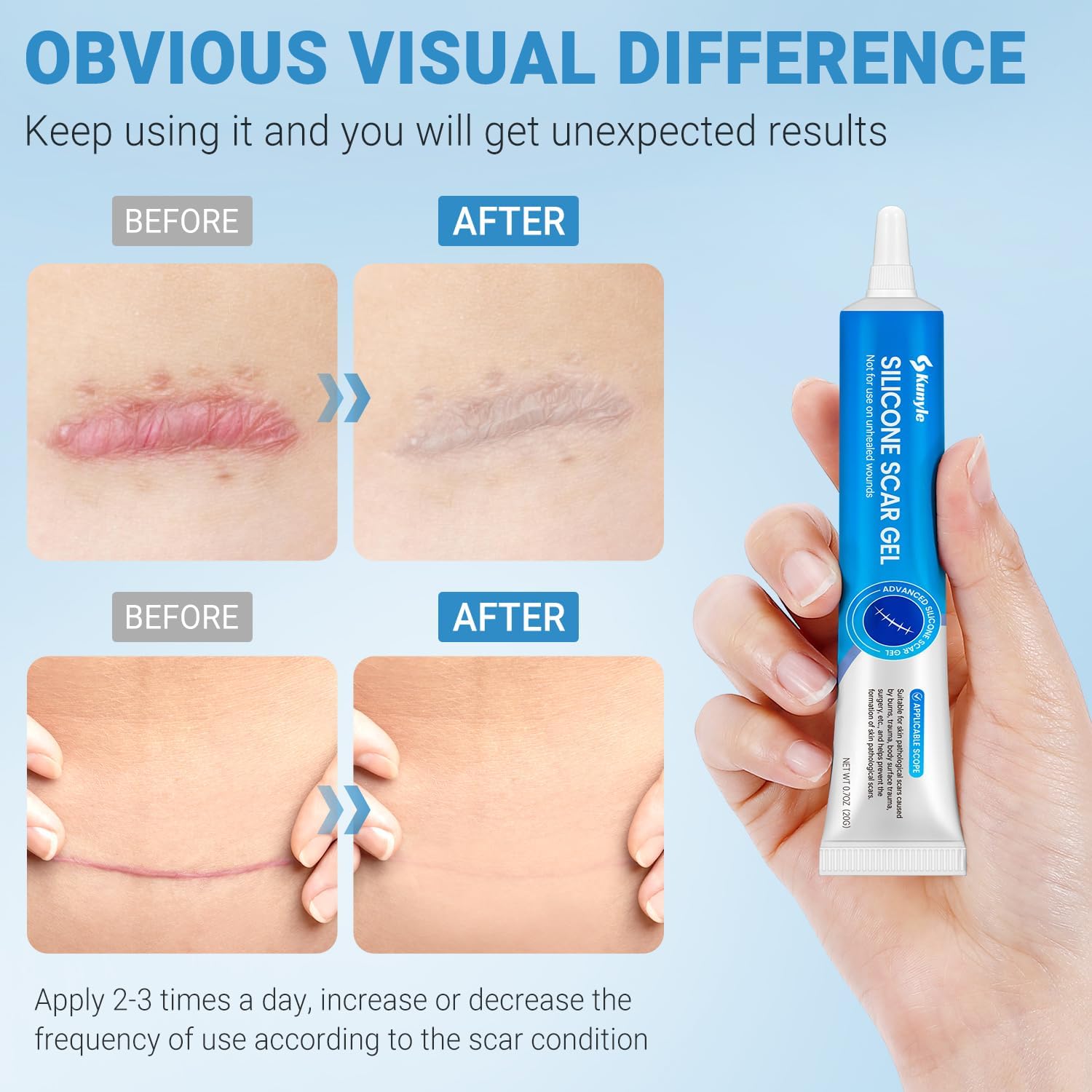 Kunyle silicone scar gel packaging shown for travel-friendly care