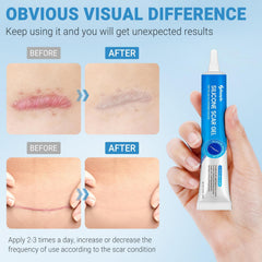 Kunyle silicone scar gel packaging shown for travel-friendly care