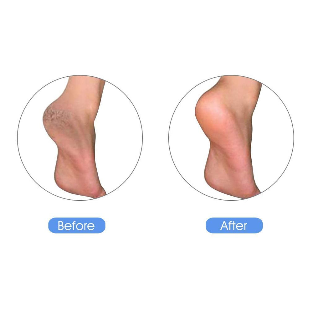 KuuCare pumice stone beside soap and water for quick cleaning