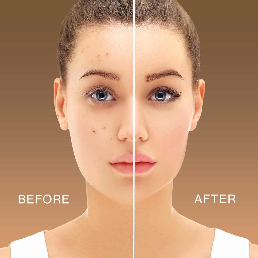 L.A. Girl HD Pro.Conceal redness camouflage hides red areas